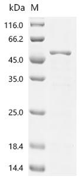 Recombinant Human Paraneoplastic antigen Ma2 (PNMA2), partial