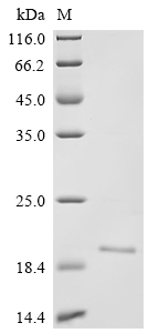 Recombinant Varicella-zoster virus Envelope glycoprotein B (gB), partial
