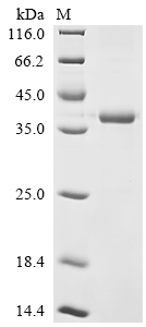 Recombinant Human Unconventional myosin-X (MYO10), partial