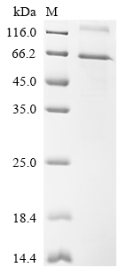 Recombinant Mouse Netrin-G1 (Ntng1)