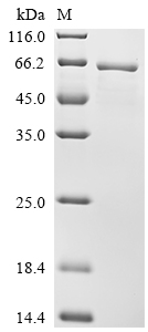 Recombinant Human Ryanodine receptor 1 (RYR1), partial