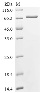 Recombinant Schistosoma japonicum Glutathione S-transferase class-mu 26 kDa isozyme, Biotinylated