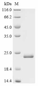 Recombinant Human Androgen receptor (AR), partial