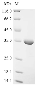 Recombinant Mouse Lys-63-specific deubiquitinase BRCC36 (Brcc3)