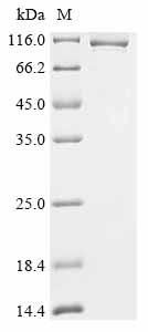 Recombinant Human Splicing factor U2AF 65 kDa subunit (U2AF2), Biotinylated