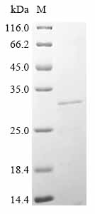 Recombinant Mouse Angiopoietin-like protein 8 (Angptl8)