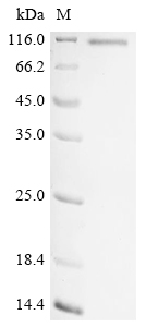Recombinant Human Serine/threonine-protein kinase PLK2 (PLK2)