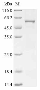 Recombinant Rat Muscle, skeletal receptor tyrosine protein kinase (Musk), partial