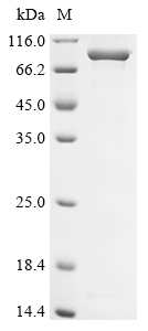 Recombinant Human Delta-1-pyrroline-5-carboxylate synthase (ALDH18A1)