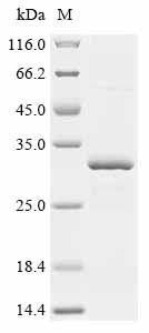 Recombinant Lake Victoria marburgvirus Polymerase cofactor VP35 (VP35)