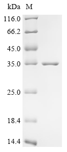 Recombinant Escherichia coli O157:H7 Curli production assembly/transport component CsgG (csgG)