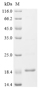 Recombinant Human herpesvirus 2 Protein UL20 (UL20), partial