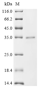 Recombinant Human herpesvirus 2 Envelope glycoprotein L (gL)
