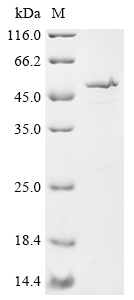 Recombinant Human Cytochrome P450 2A6 (CYP2A6), partial