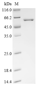 Recombinant Vaccinia virus Serine/threonine-protein kinase 2 (OPG054)