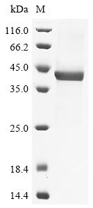 Recombinant Human Prostatic acid phosphatase (ACP3), partial