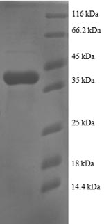 Recombinant Human Small ribosomal subunit protein eS25 (RPS25)