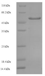 Recombinant Human Tyrosine-protein phosphatase non-receptor type substrate 1 (SIRPA), partial
