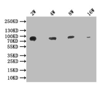 His Tag Antibody