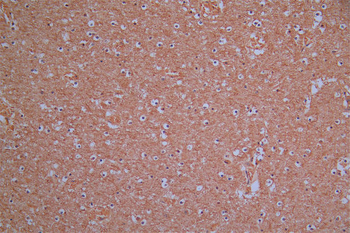 ROBO1 Antibody