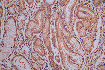 ROBO1 Antibody