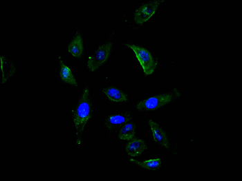 ROBO1 Antibody