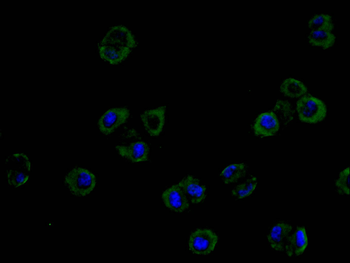 ROBO1 Antibody