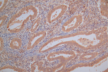 PRDX2 Antibody