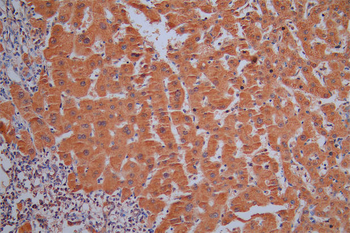 SNCG Antibody