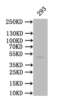 CALR Antibody