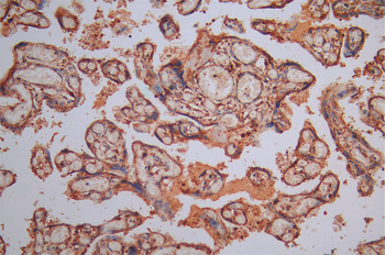 CALR Antibody