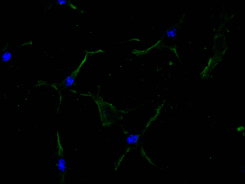 ITGAV Antibody