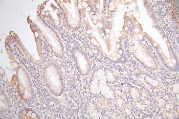 GJB2 Antibody