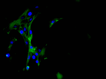 GSN Antibody