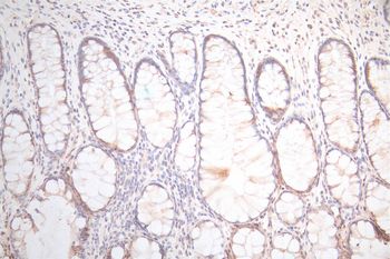 UBE2C Antibody