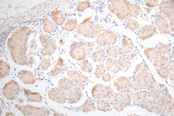 UBE2C Antibody