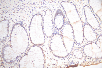 PDPN Antibody
