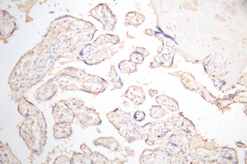 PDPN Antibody
