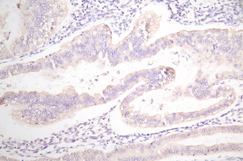 EPCAM Antibody