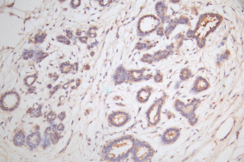 CTNNB1 Antibody