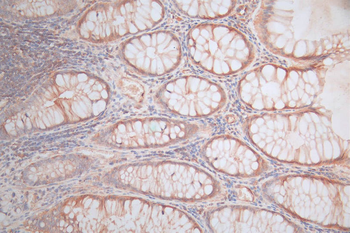 CTNNB1 Antibody