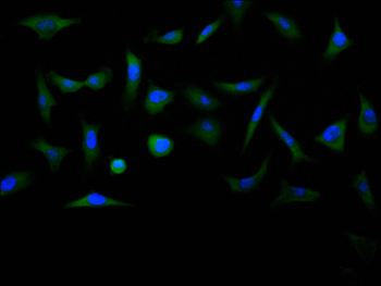 CTNNB1 Antibody
