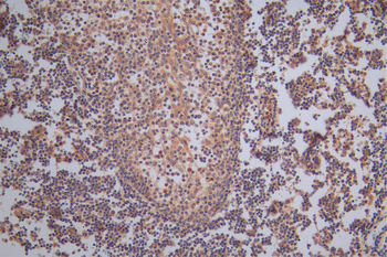 TK1 Antibody