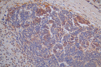 TK1 Antibody