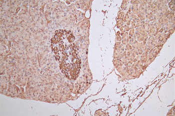 FGFR1 Antibody