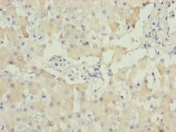 AKR1D1 Antibody