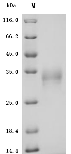 Recombinant Human Tumor necrosis factor ligand superfamily member 15(TNFSF15) (Active)