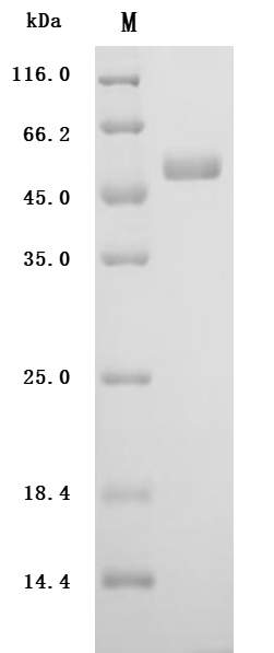 Recombinant Human Urokinase-type plasminogen activator(PLAU) (Active)