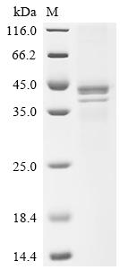 Recombinant Human Guanine nucleotide-binding protein G(i) subunit alpha-1 (GNAI1)
