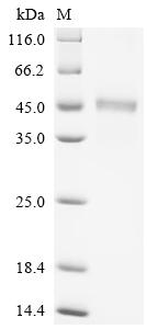 Recombinant Rat Zinc transporter ZIP6 (Slc39a6), partial